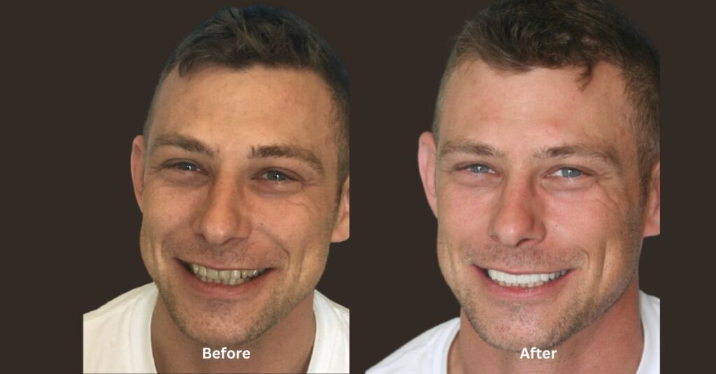 There are many teeth whitening options in WA.